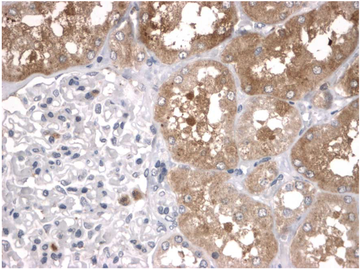 Figure 1. Immunohistochemical staining of human kidney using PD1 antibody (Cat. No. X2798P). Antibody used at 2 μg/ml. 40x magnification. Pathologists Comments: Granular staining in the cytoplasm of tubular cells and in scattered glomerular
cells.